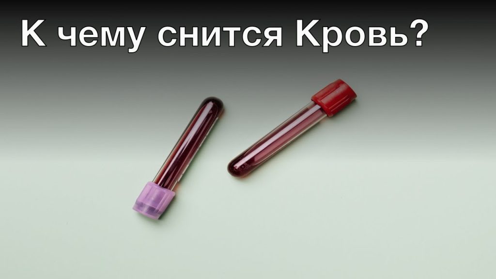 К Чему Снится Кровь: Толкование и Значение Сновидений о Крови
